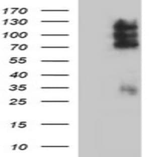 anti-CD44 (CD44) antibody avatar