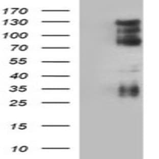 anti-CD44 (CD44) antibody avatar