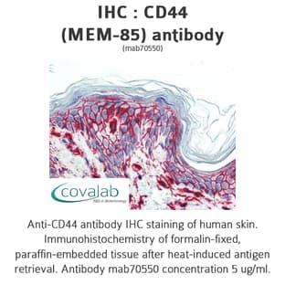 anti-CD44 (CD44) antibody avatar