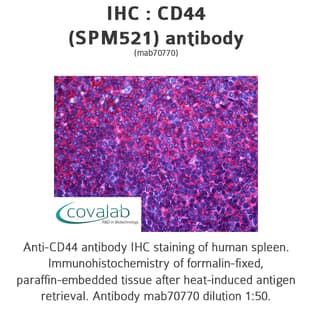 anti-CD44 (CD44) antibody avatar