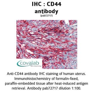 anti-CD44 (CD44) antibody avatar