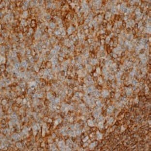 anti-CD44 (CD44) antibody avatar