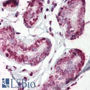 anti-CD44 (CD44) (AA 21-145) antibody avatar