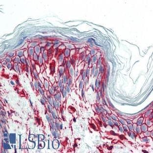 anti-CD44 (CD44) antibody avatar