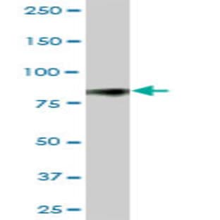 anti-CD44 (CD44) (AA 1-361) antibody avatar
