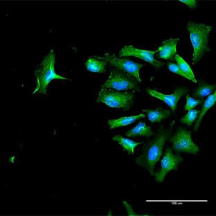 anti-CD44 (CD44) (AA 1-361) antibody avatar