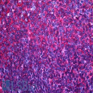 anti-CD44 (CD44) antibody avatar