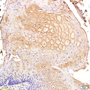 anti-CD44 (CD44) antibody avatar