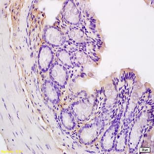 anti-CD44 (CD44) antibody avatar