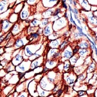 anti-CD44 (CD44) antibody avatar