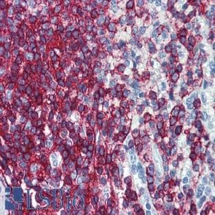 anti-CD44 (CD44) antibody (FITC) avatar