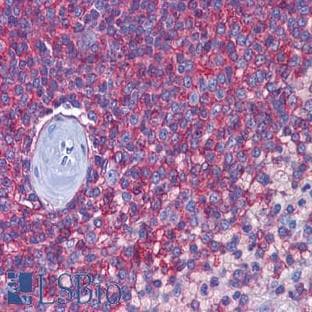 anti-CD44 (CD44) antibody avatar