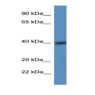 anti-CD44 (CD44) antibody avatar