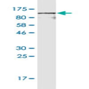 anti-CD44 (CD44) (AA 1-699) antibody avatar