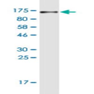 anti-CD44 (CD44) (AA 1-699) antibody avatar
