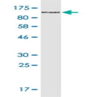 anti-CD44 (CD44) (AA 1-699) antibody avatar