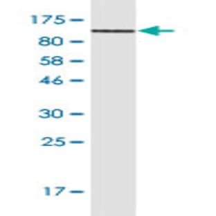 anti-CD44 (CD44) (AA 1-699) antibody avatar