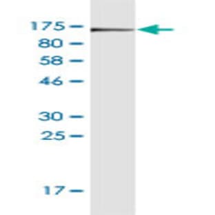 anti-CD44 (CD44) (AA 1-699) antibody avatar