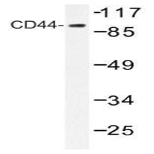 anti-CD44 (CD44) antibody avatar