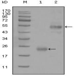 anti-CD44 (CD44) antibody avatar