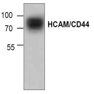 anti-CD44 (CD44) antibody avatar