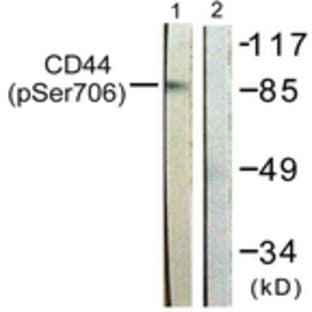 anti-CD44 (CD44) (pSer706) antibody avatar