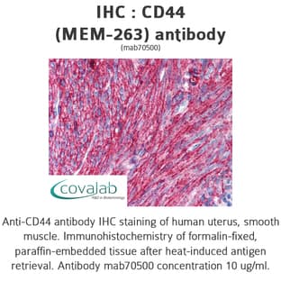 anti-CD44 (CD44) antibody avatar
