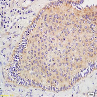 anti-CD44 (CD44) (Exon v10) antibody avatar