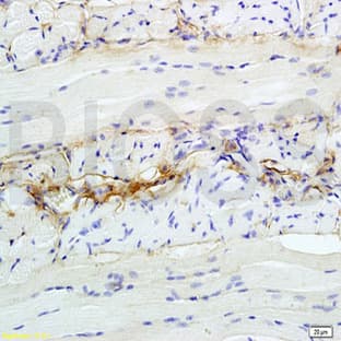 anti-CD47 (CD47) antibody avatar