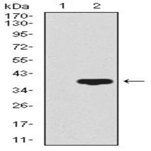 anti-CD59 (CD59) (AA 31-111) antibody avatar