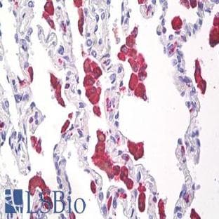 anti-CD68 Molecule (CD68) antibody avatar