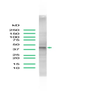 anti-CD68 Molecule (CD68) (AA 155-355) antibody avatar
