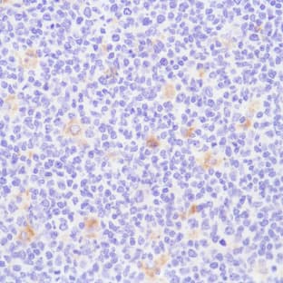 anti-CD68 Molecule (CD68) (Internal Region) antibody avatar