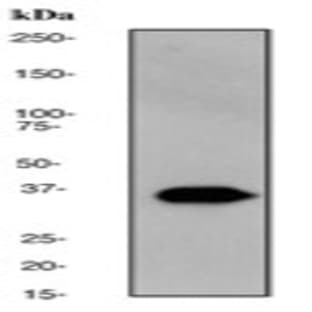 anti-CD68 Molecule (CD68) (N-Term) antibody avatar