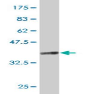 anti-CD68 Molecule (CD68) (AA 164-262) antibody avatar