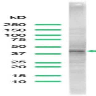 anti-CD68 Molecule (CD68) (AA 155-355) antibody avatar