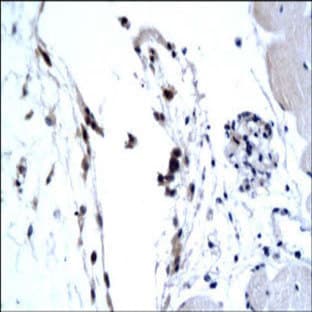 anti-CD68 Molecule (CD68) (N-Term) antibody avatar