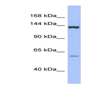 anti-DEAH (Asp-Glu-Ala-His) Box Polypeptide 34 (DHX34) (Middle Region) antibody avatar