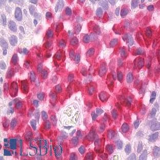 anti-CD79a Molecule, Immunoglobulin-Associated alpha (CD79A) antibody avatar