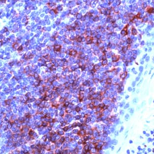 anti-CD79a Molecule, Immunoglobulin-Associated alpha (CD79A) (N-Term) antibody avatar