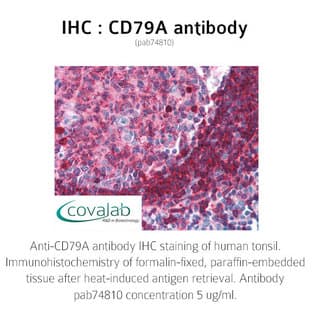 anti-CD79a Molecule, Immunoglobulin-Associated alpha (CD79A) antibody avatar