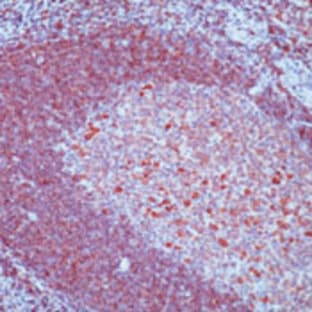 anti-CD79a Molecule, Immunoglobulin-Associated alpha (CD79A) antibody avatar