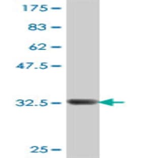 anti-CD79a Molecule, Immunoglobulin-Associated alpha (CD79A) (AA 33-140) antibody avatar