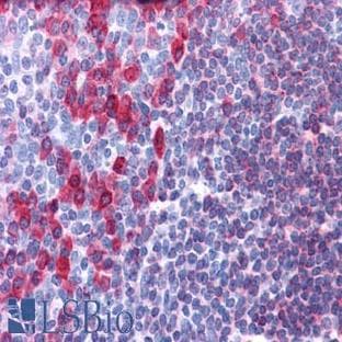 anti-CD79a Molecule, Immunoglobulin-Associated alpha (CD79A) antibody avatar