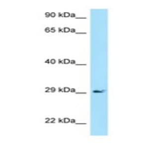 anti-CD79a Molecule, Immunoglobulin-Associated alpha (CD79A) (N-Term) antibody avatar