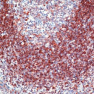anti-CD79a Molecule, Immunoglobulin-Associated alpha (CD79A) antibody avatar