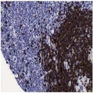 anti-CD79a Molecule, Immunoglobulin-Associated alpha (CD79A) (N-Term) antibody avatar