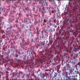 anti-CD79a Molecule, Immunoglobulin-Associated alpha (CD79A) antibody avatar