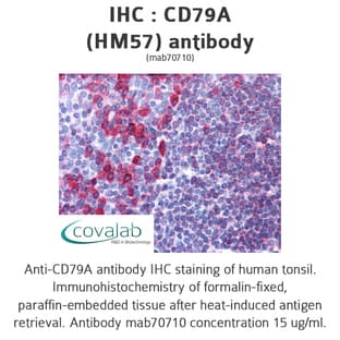 anti-CD79a Molecule, Immunoglobulin-Associated alpha (CD79A) (AA 202-216) antibody avatar