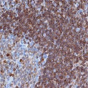 anti-CD79a Molecule, Immunoglobulin-Associated alpha (CD79A) antibody avatar